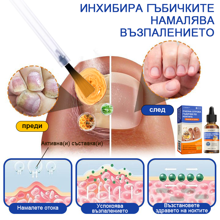 Furzero™🚚Лечение на гъбички по ноктите с пчелна отрова: Пълно решение на проблема с гъбичките по ноктите 🐝