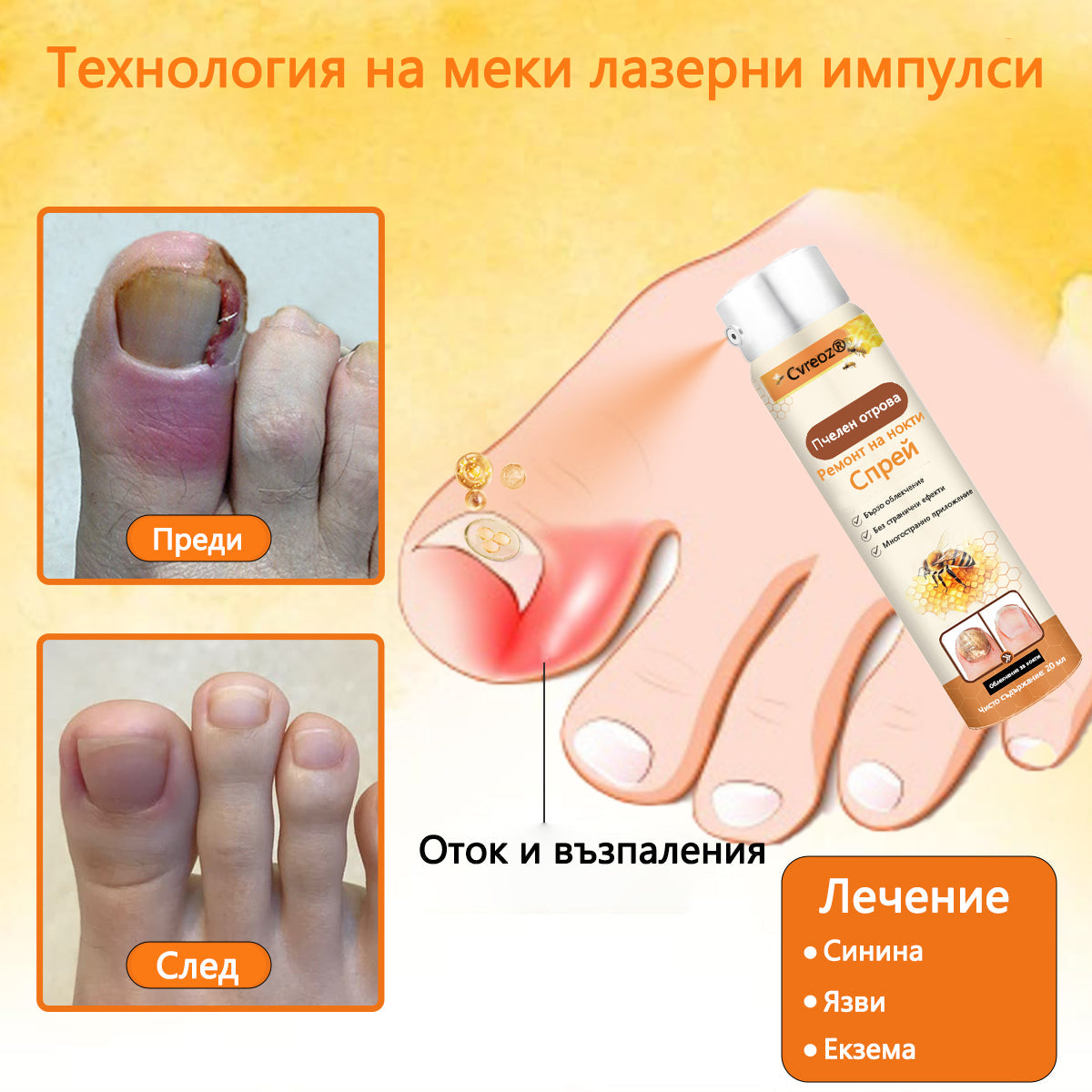 Cvreoz® 🛡️Спрей с пчелна отрова ⏳Унищожава бактериите за 1 минута, почти пълно възстановяване само след 2 седмици👣