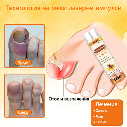 Cvreoz® 🛡️Спрей с пчелна отрова ⏳Унищожава бактериите за 1 минута, почти пълно възстановяване само след 2 седмици👣