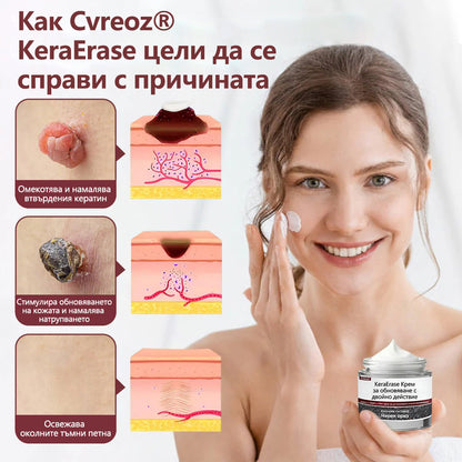 Cvreoz® 🌟KeraErase Крем за обновяване с двойно действие🌿