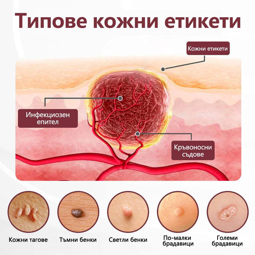 Cvreoz® 🌟KeraErase Крем за обновяване с двойно действие🌿
