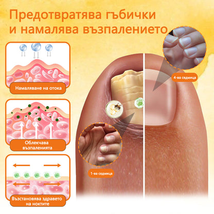 Cvreoz® 🛡️Спрей с пчелна отрова ⏳Унищожава бактериите за 1 минута, почти пълно възстановяване само след 2 седмици👣