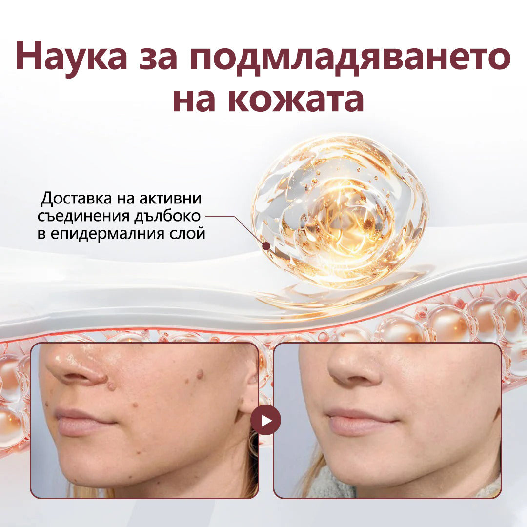 Cvreoz® 🌟KeraErase Крем за обновяване с двойно действие🌿