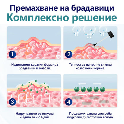 Timilk®🌲 WartLift Лек за брадавици и кокоши трън💧